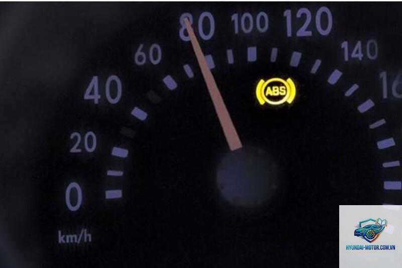 abs light on là gì - Hình 3