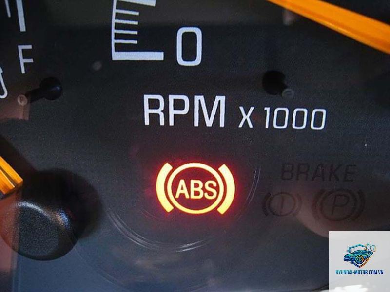 abs light on là gì - Hình 5