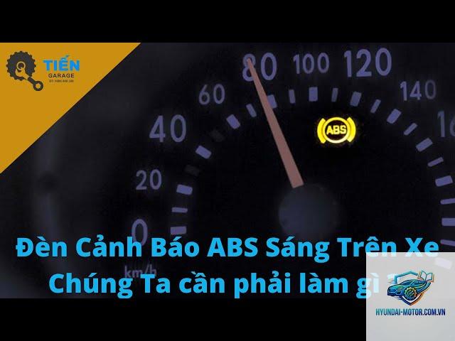 xe máy abs sáng đèn - Hình 3